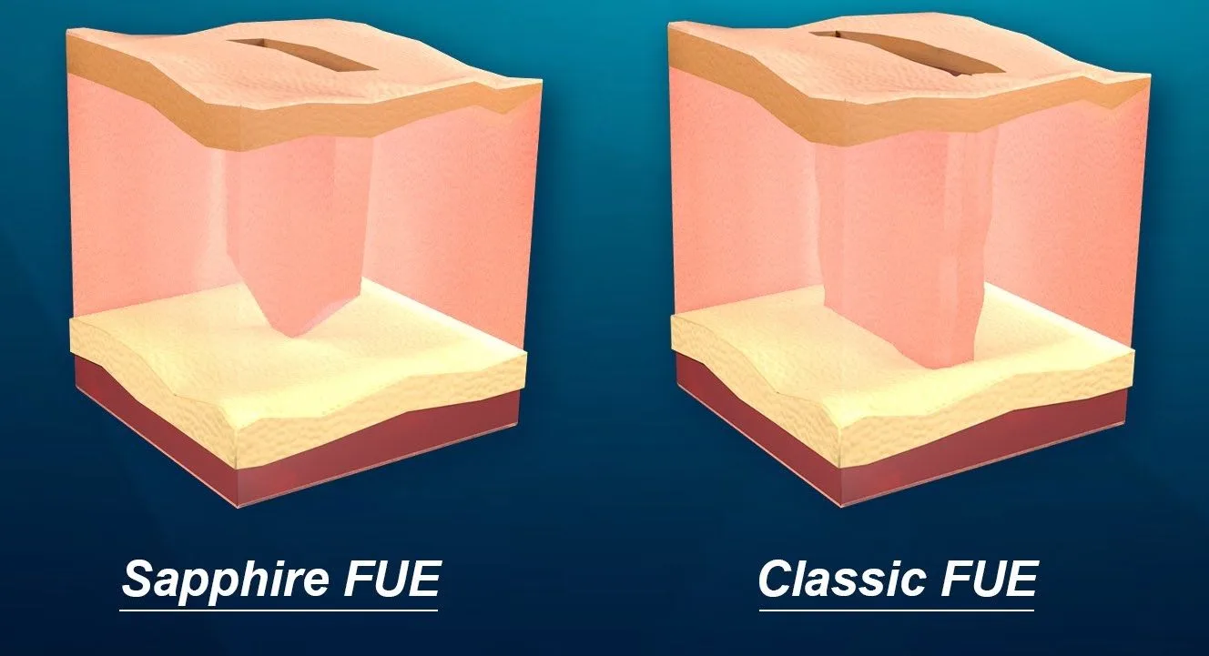safir jpg