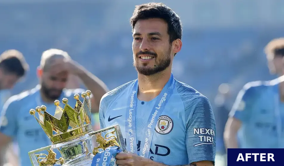 david silva after hair transplant 2020