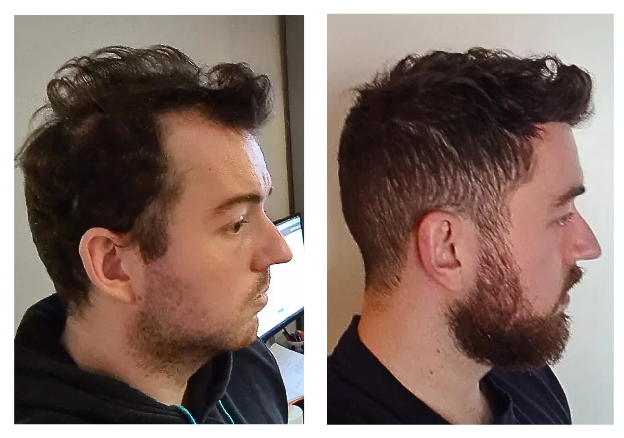 before after 1
