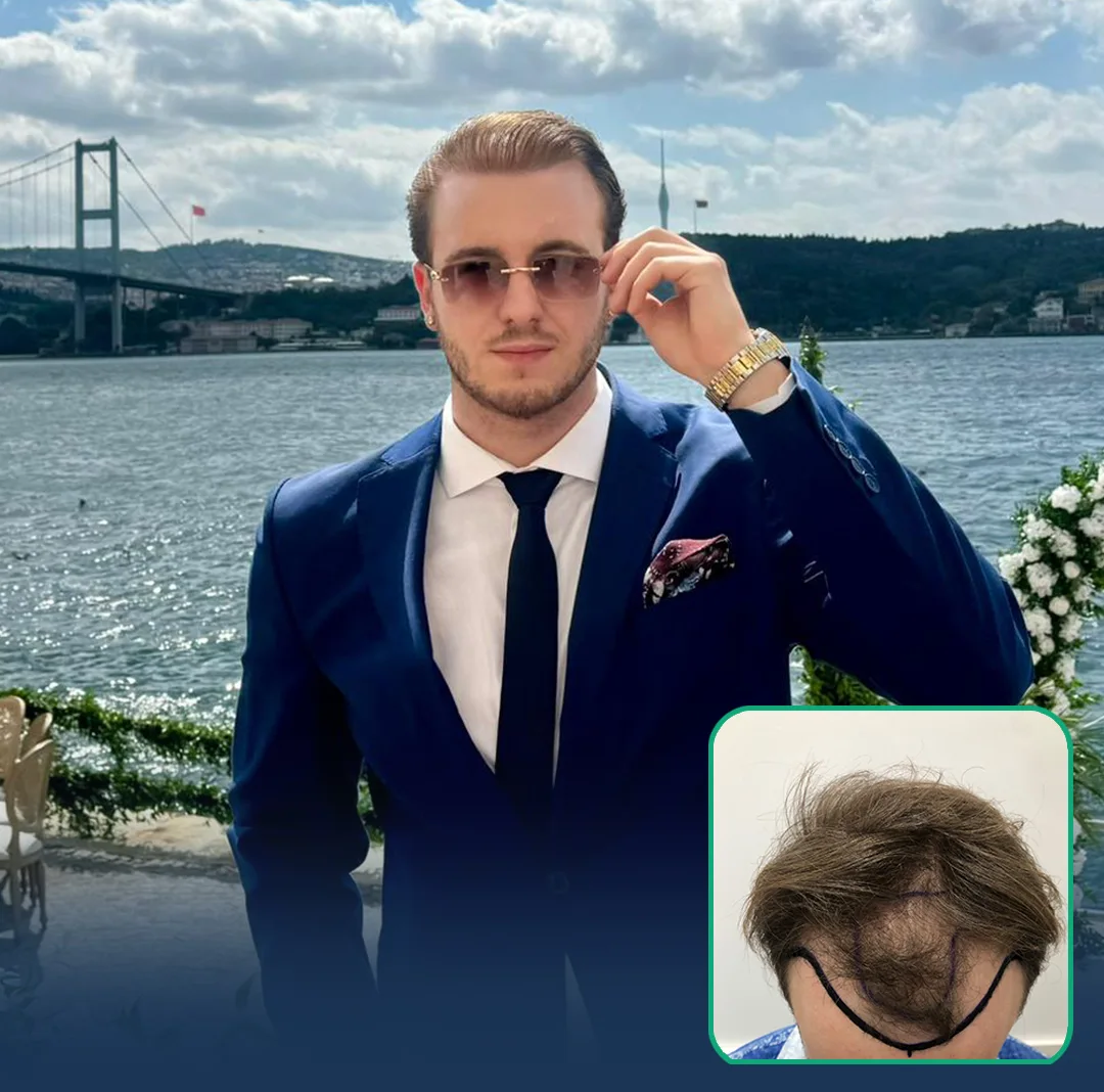 hair clinic result london